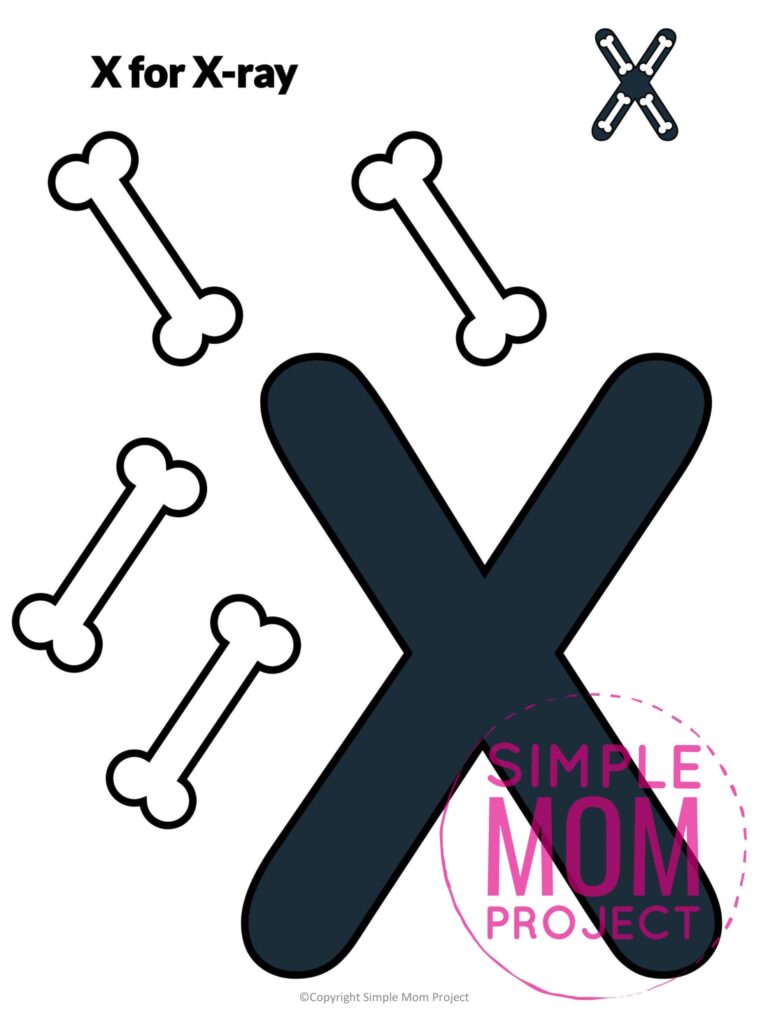 Free Printable Letter X Craft Template For Xray Learning Activities